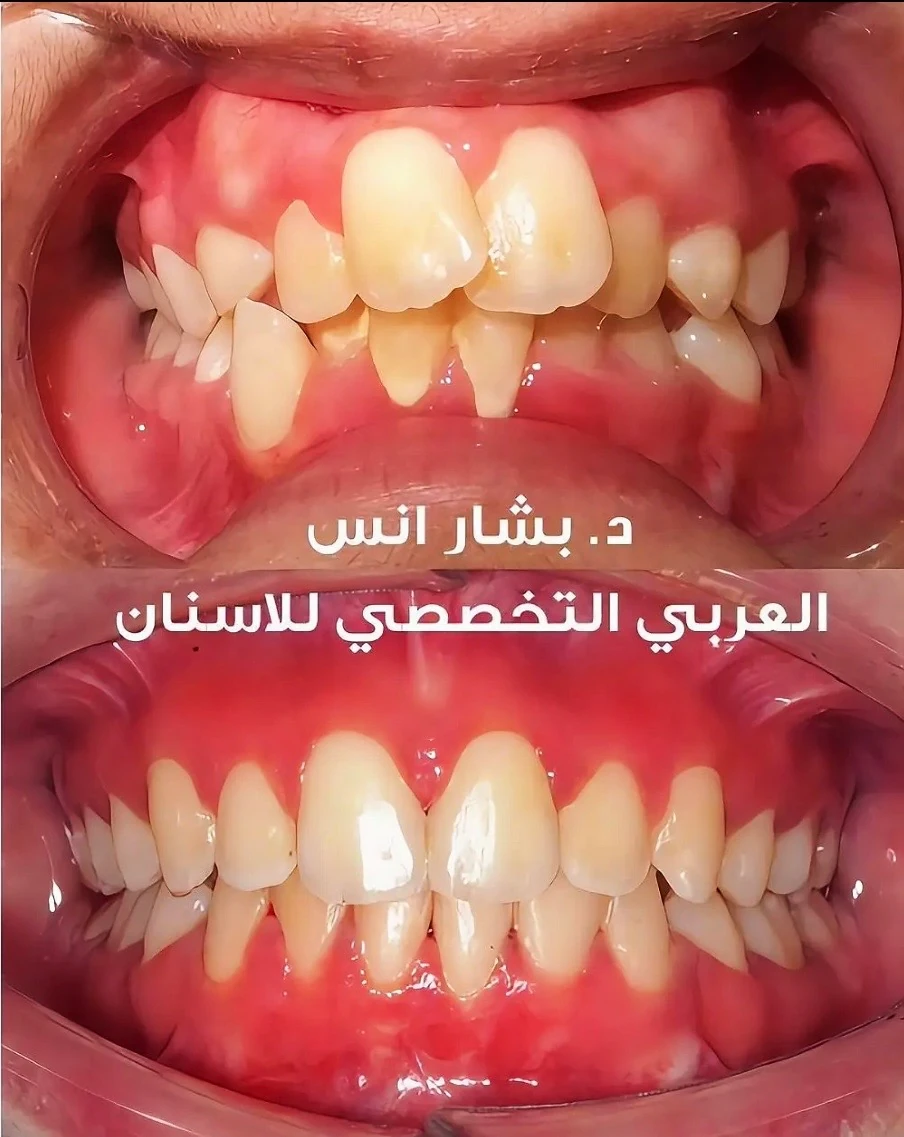 Orthodontics