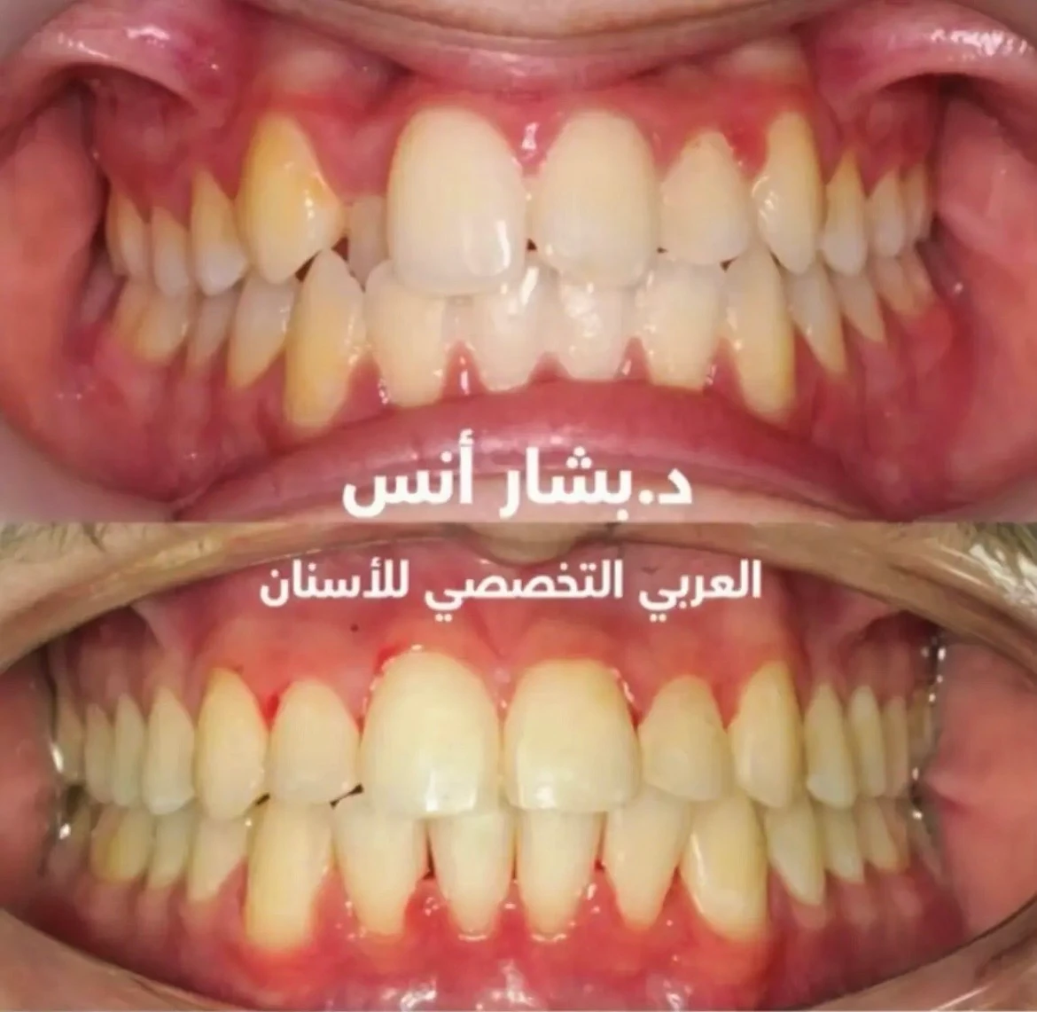 Orthodontics