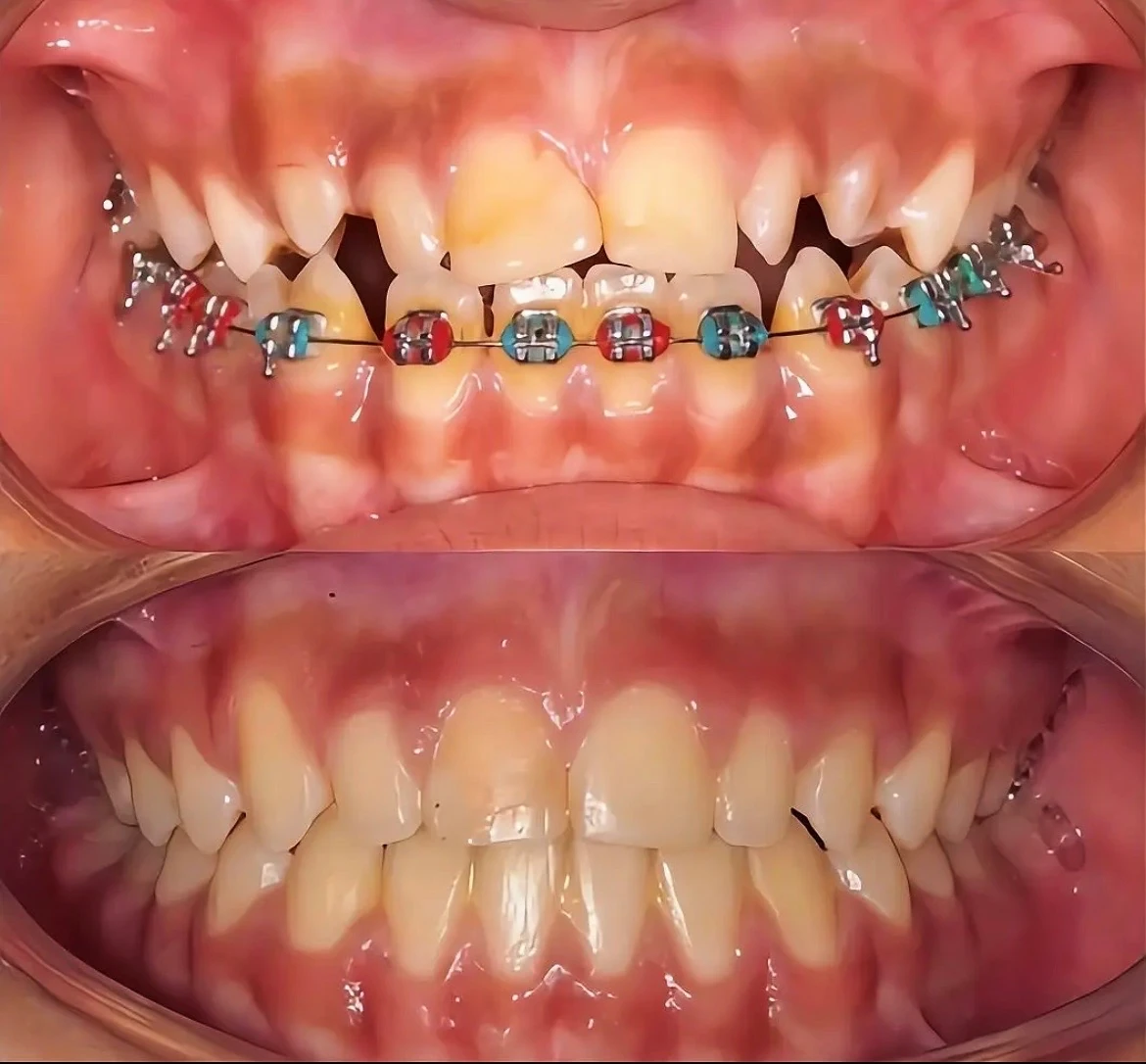 Orthodontics