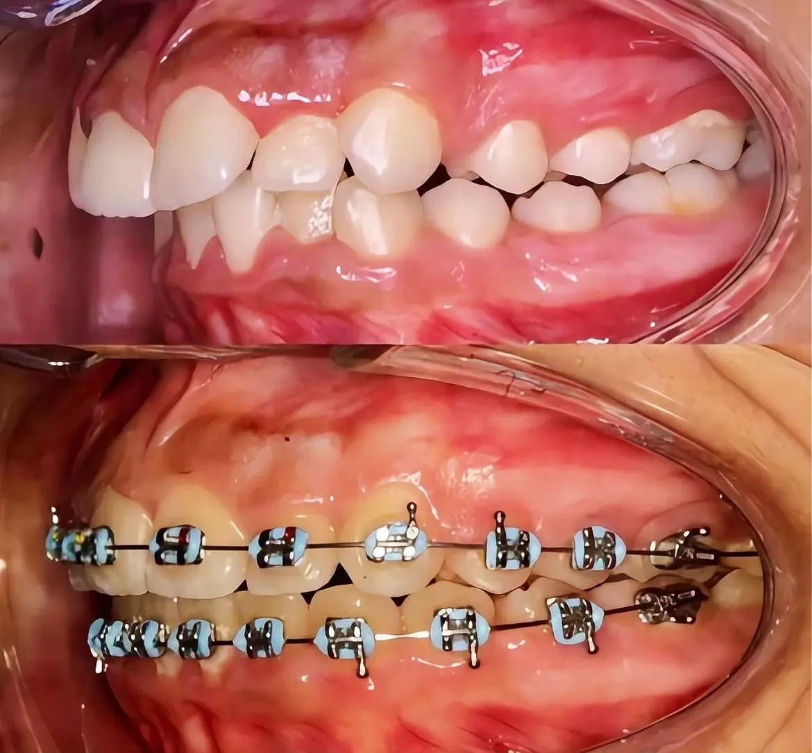 Orthodontics